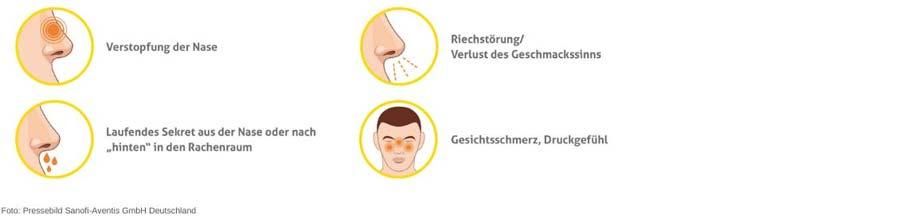 Typische Symptome einer chronischen Nasennebenhöhlenentzündung mit Polypenbildung: Verstopfung der Nase, Riechstörung/Verlust des Geschmackssinns, Laufendes Sekret aus der Nase oder nach "hinten" in den Rachenraum, Gesichtschmerz, Druckgefühl