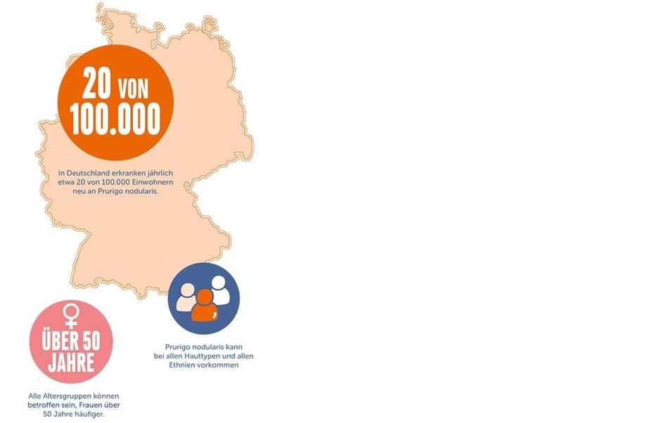 In Deutschland erkranken jährlich etwa 20 von 100.000 Einwohnern neu an Prurigo nodularis.